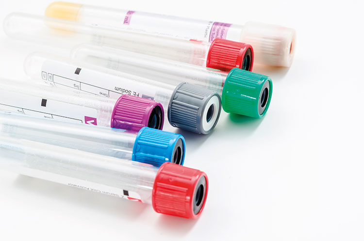 Consommable de laboratoire